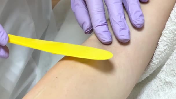 Vrouw cosmetoloog zet een laser ontharing gel — Stockvideo