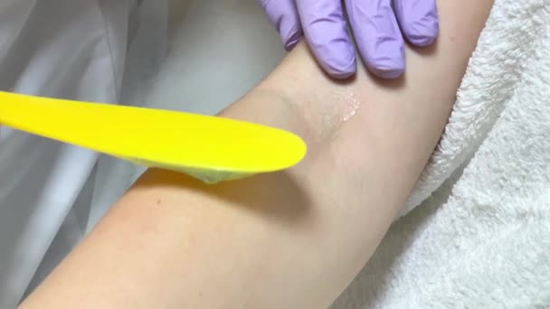 Женщина-косметолог ставит гель для лазерной эпиляции — стоковое видео