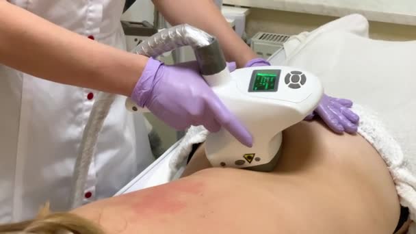 Cura della pelle. Cosmetologo fa una donna massaggio lpg sulla schiena — Video Stock
