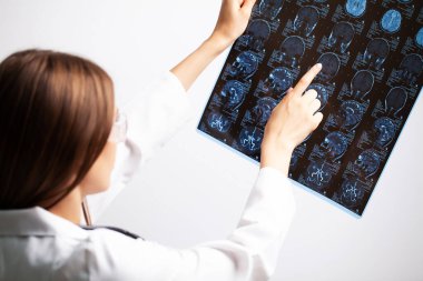 Genç bir doktor hastanın MR görüntüsünü inceliyor.