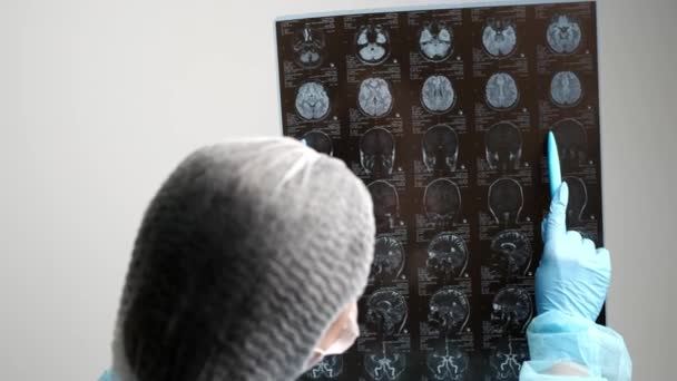 O médico examina uma imagem de RM do cérebro dos pacientes — Vídeo de Stock