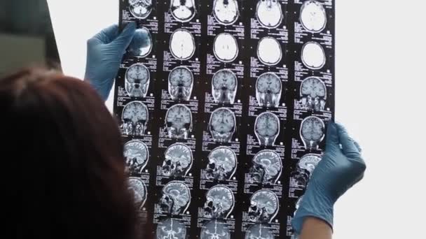 Läkaren undersöker en MRT-bild av patientens hjärna — Stockvideo