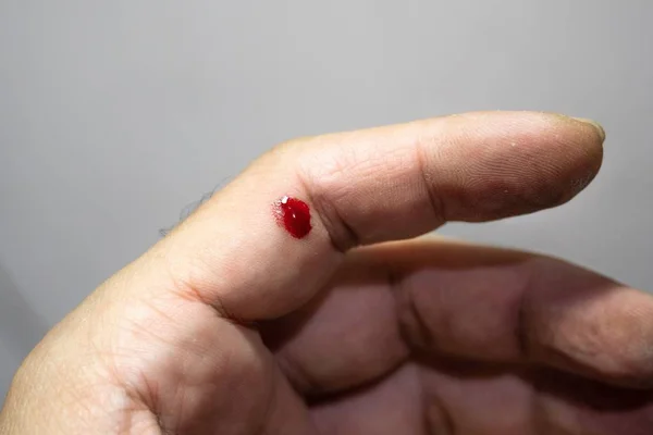 Dedo Sangrando Com Chave Fenda Minúscula — Fotografia de Stock
