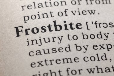 Sahte sözlük, kelime donma sözlük tanımı. anahtar açıklayıcı kelimeler de dahil olmak üzere.