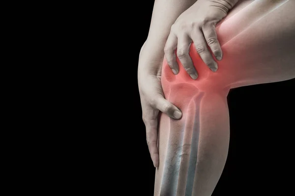 膝关节损伤在人类 Knee 关节痛人医疗 单色调突出显示在膝 — 图库照片