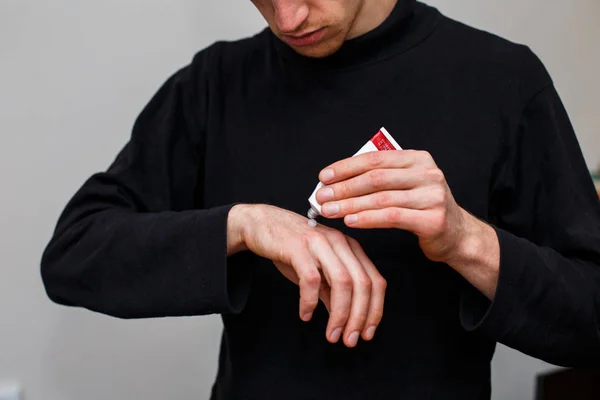 O homem está aplicando um emoliente para secar a pele escamosa como no tratamento da psoríase, eczema e outras condições de pele seca. Tubo com creme — Fotografia de Stock