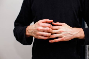 Adam kaşı kendini kuru lapa lapa cilt yandan psoriasis vulgaris, egzama ve mantar, plak, döküntü ve düzeltme ekleri gibi diğer cilt koşulları ile. Otoimmün hastalığı genetik.