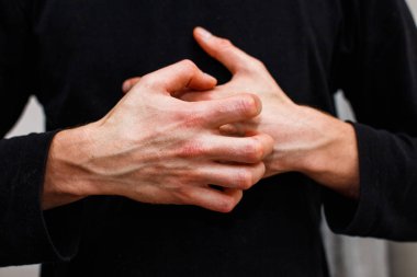 Adam kaşı kendini kuru lapa lapa cilt yandan psoriasis vulgaris, egzama ve mantar, plak, döküntü ve düzeltme ekleri gibi diğer cilt koşulları ile. Otoimmün hastalığı genetik.