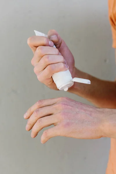 Aplicação de um emoliente na pele seca escamosa como no tratamento da psoríase, eczema e outras condições de pele seca — Fotografia de Stock