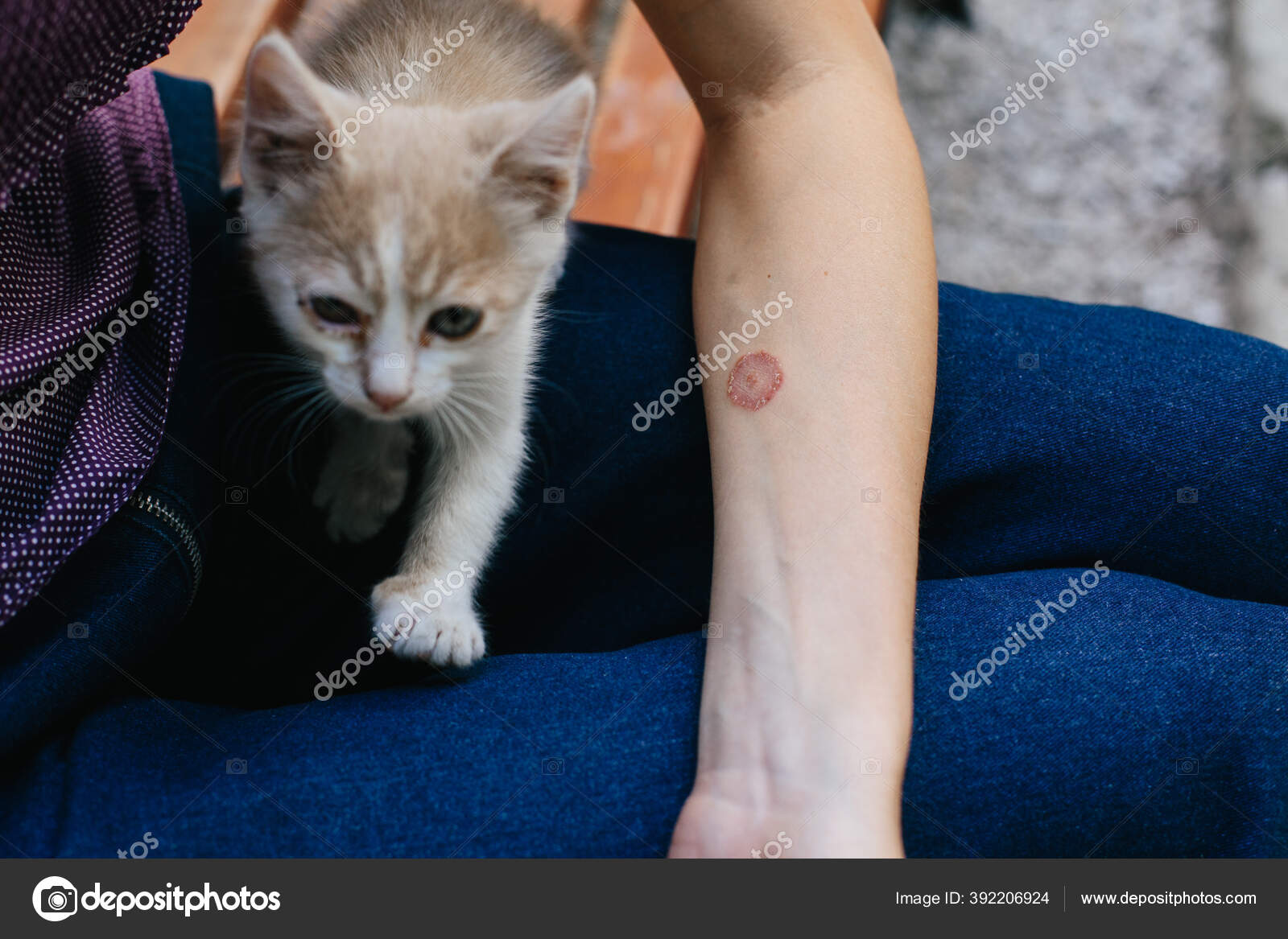 Dermatomycose Images Libres De Droit Photos De Dermatomycose Depositphotos