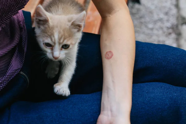 Ringworm on Arm with Hand. Cat disease. Skin problem — Stock Photo, Image