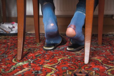 Man sits on chair on his socks can see holes clipart