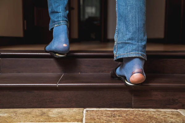 Feet in jeans and holey socks go up stairs — Stock Photo, Image