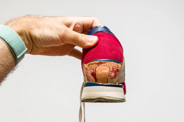 Suela rota en el deporte zapatos diarios desgaste — Foto de Stock