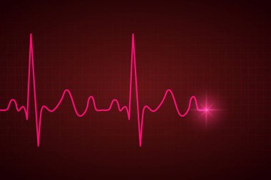 EKG kalp darbe ile sağlık tıbbi geçmişi