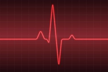 EKG kalp darbe ile sağlık tıbbi geçmişi