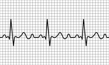 kalp atışı simgesi. Ekg Patoloji İzi