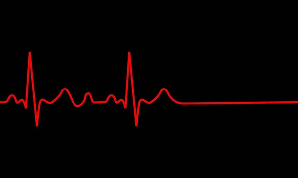 Heartbeat icon. ECG Pathology Trace — Stock Vector