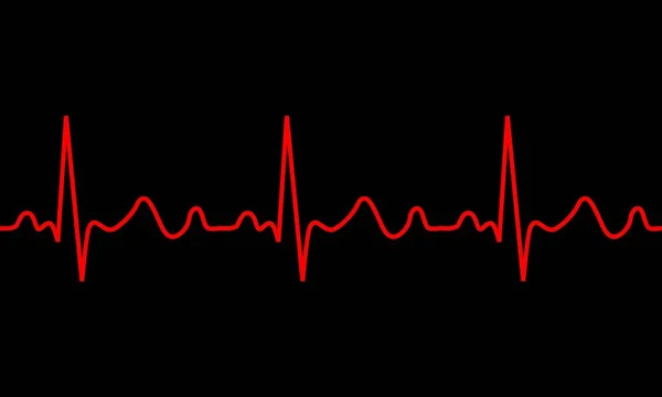 Heartbeat icon. ECG Pathology Trace — Stock Vector