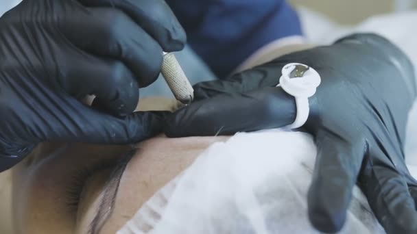 Una dipendente donna di una clinica di cosmetologia fa una routine di microblasting a una paziente donna — Video Stock