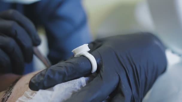 Een vrouwelijke werknemer van een kliniek cosmetologie maakt een routine microblasting aan een vrouwelijke patiënt — Stockvideo