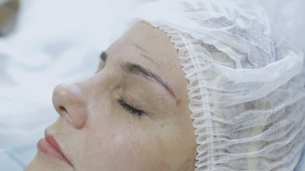 Eine Mitarbeiterin einer kosmetologischen Klinik macht einer Patientin eine Mikrostrahlung — Stockvideo