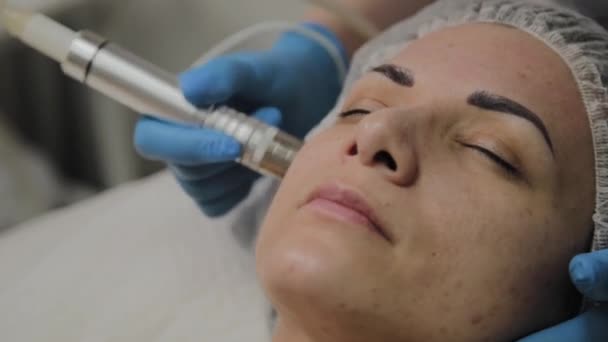 Un cosmetólogo profesional hace que una mujer limpie la cara al vacío en un salón de belleza. Innovaciones cosmetológicas . — Vídeo de stock