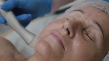 Profesyonel kozmetoloji ofisinde mikroakımlı yaşlı bir kadın için işlem yapar.