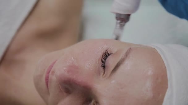 Professionell kosmetolog utför Dermapen förfarande i en kosmetika klinik. — Stockvideo