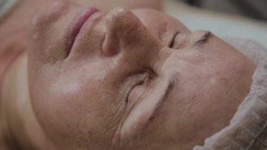 Yaşlı bir kadın kozmetoloji kliniğinde kanepede yatıyor..