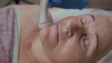 Profesyonel kozmetoloji ofisinde mikroakımlı yaşlı bir kadın için işlem yapar.
