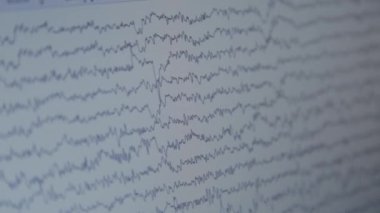 İnsan beyin aktivitesiizleme sonuçları ile monitöryakın çekim.