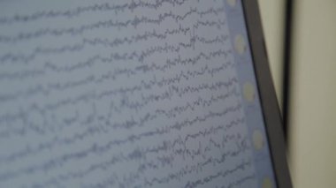 İnsan beyin aktivitesiizleme sonuçları ile monitöryakın çekim.