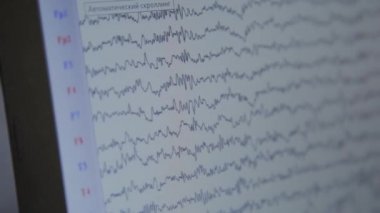 İnsan beyin aktivitesiizleme sonuçları ile monitöryakın çekim.