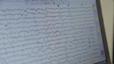 İnsan beyin aktivitesiizleme sonuçları ile monitöryakın çekim.