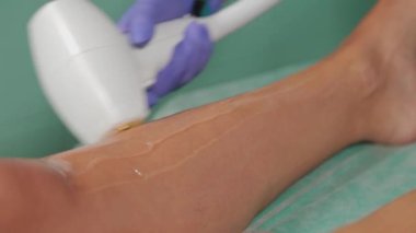 Güzellik uzmanı bacaklarda lazer çıkartıyor..