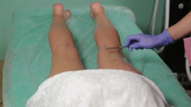 Güzellik uzmanı vücudunda lazer tüy aldırmak için bir yer hazırlıyor..