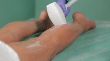 Güzellik uzmanı bacaklarda lazer çıkartıyor..