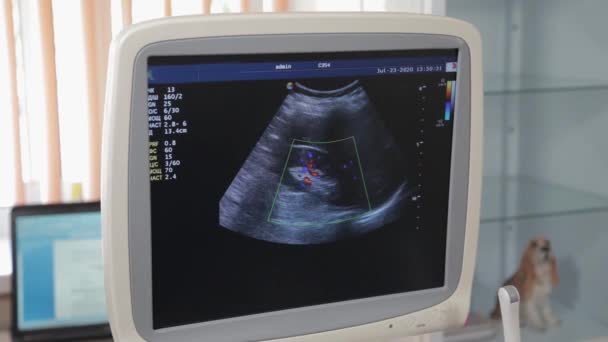 Dispozitiv cu ultrasunete într-un centru medical. Imagine ecran . — Videoclip de stoc