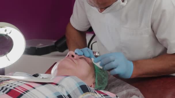 Male doctor removes papillomas of an elderly woman with an electric scalpel. — Stock Video