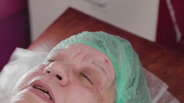 Elderly woman with papillomas on her face at the medical center. — Stock Video