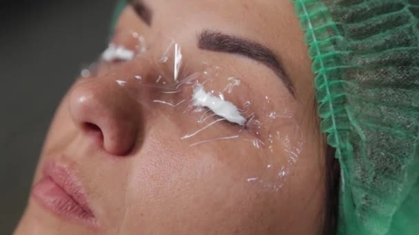 Eine Frau mit schmerzstillendem Gel auf den Wimpern. — Stockvideo