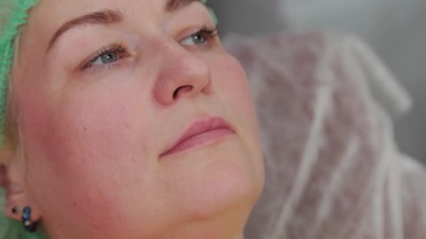 Vacker kvinna som applicerar bedövningsmedel gel på läppar. — Stockvideo