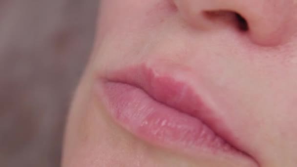 Doctor cosmetoloog maakt lip vergroting van de vrouw. — Stockvideo