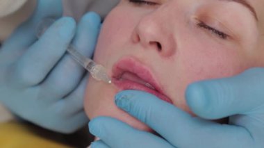 Doktor kozmetik uzmanı kadına dudak büyütme ameliyatı yapıyor..