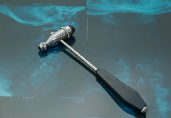Neurolog železné kladivo na rentgenu na klinice. — Stock fotografie