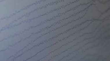 Bilgisayar ekranında EEG diyagramı.