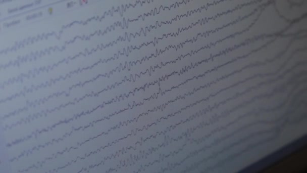컴퓨터 모니터에 있는 EEG 도표. — 비디오