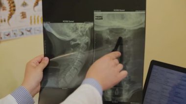 Erkek nörolog röntgene bakıyor..