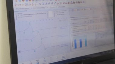 Tıbbi göstergelere sahip bilgisayar monitörü.